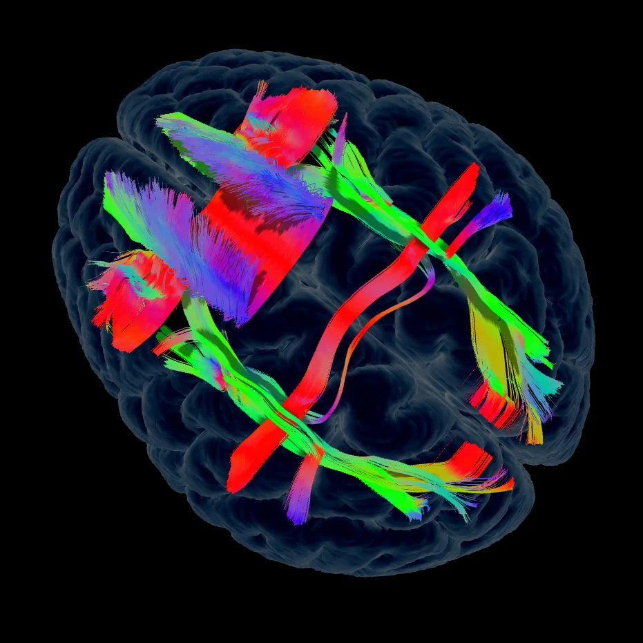 04 Working Memory Network