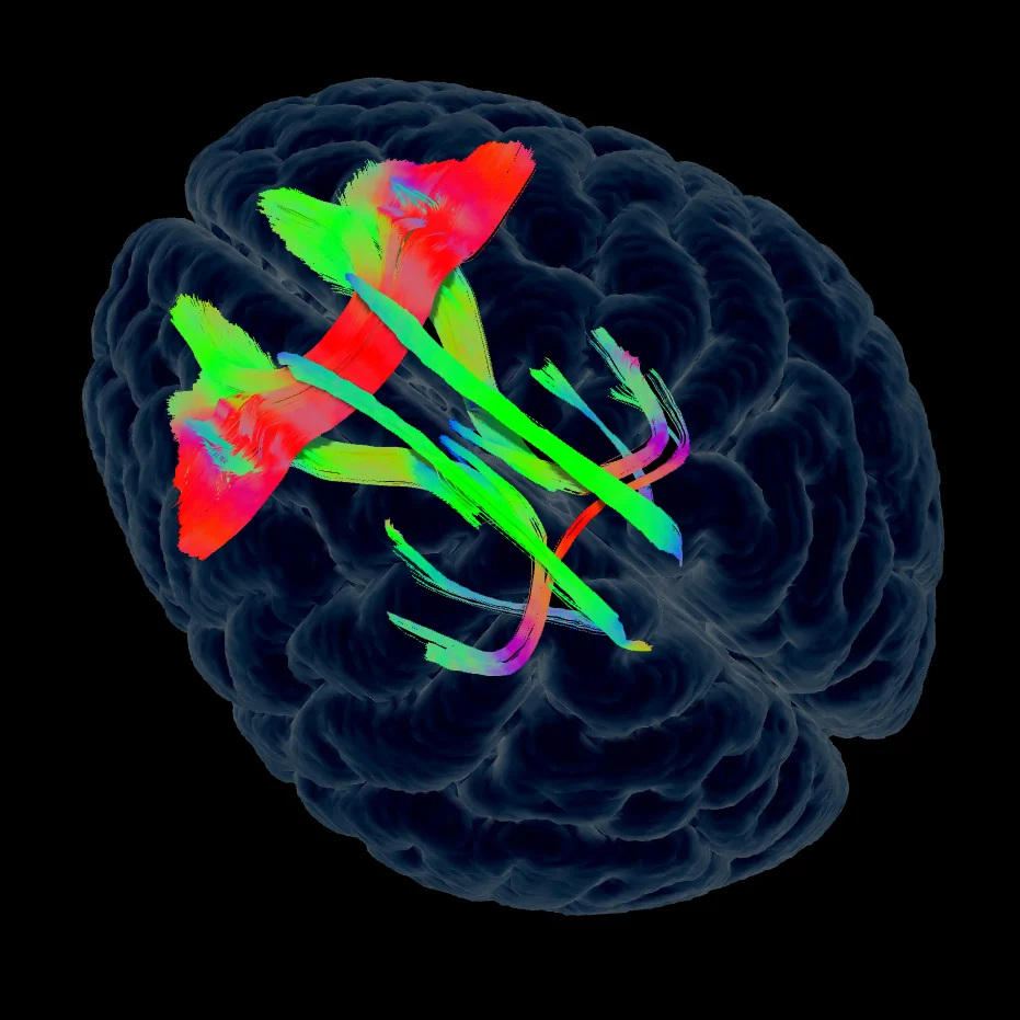 01 Long Term Episodic Emotion Network