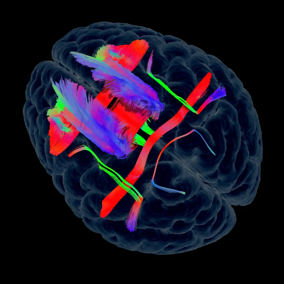 03 Long Term Implicit Memory Network