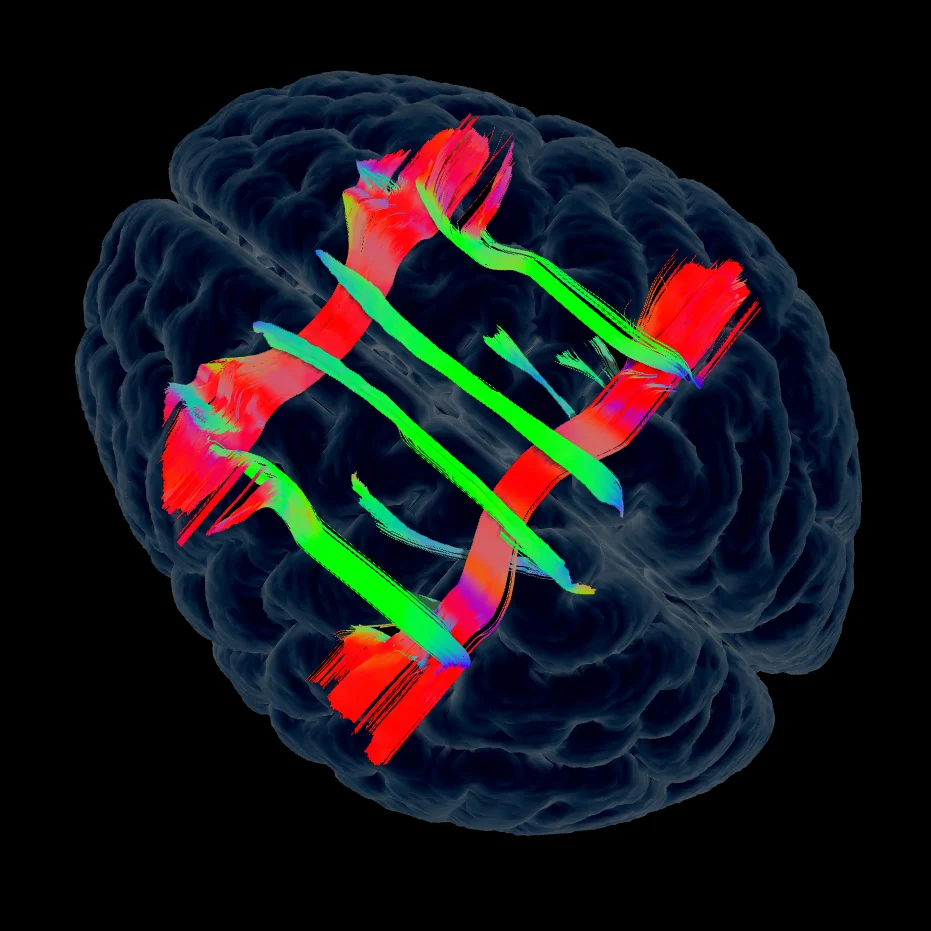 02 Long Term Semantic Memory Network