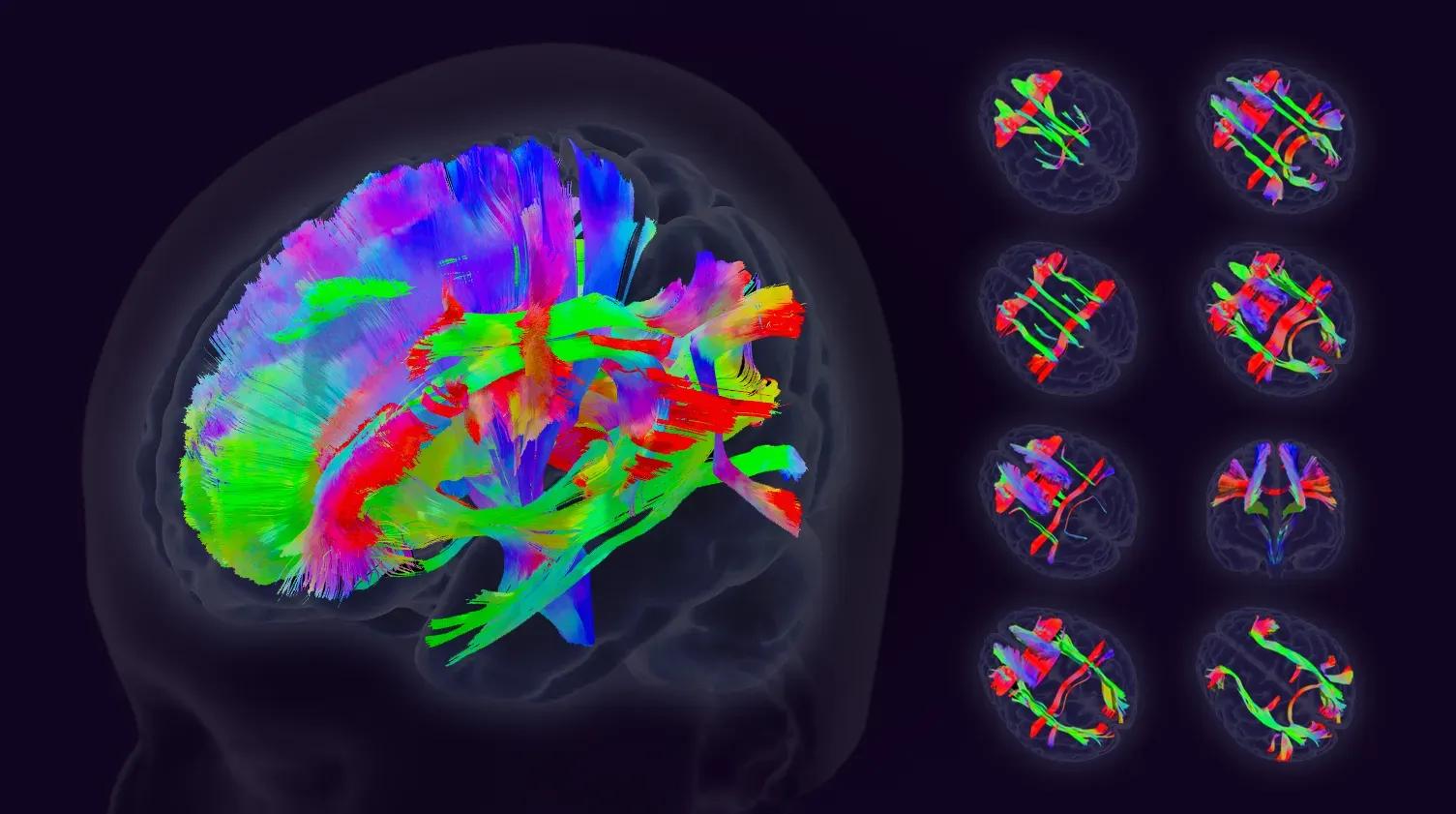Tractography